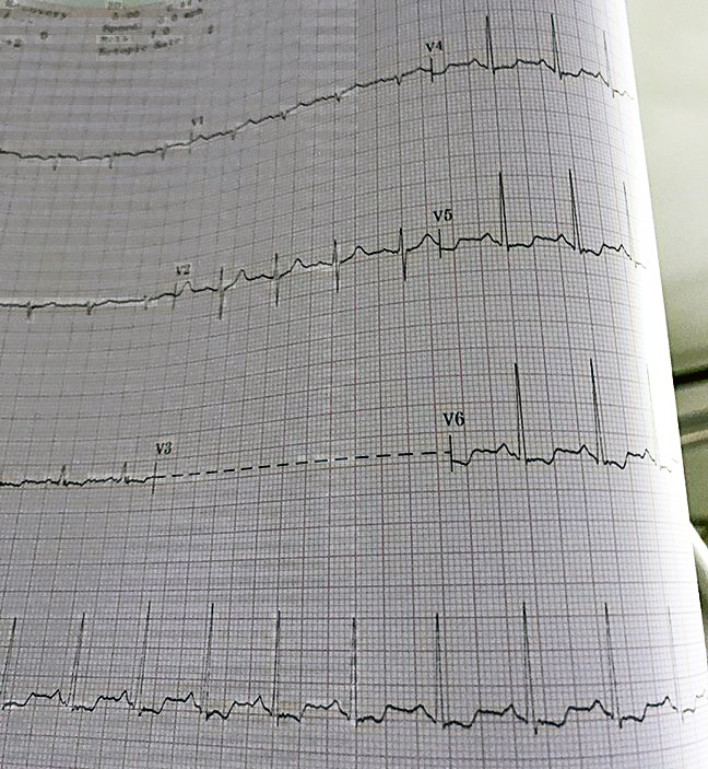 State of the&nbsp;heart